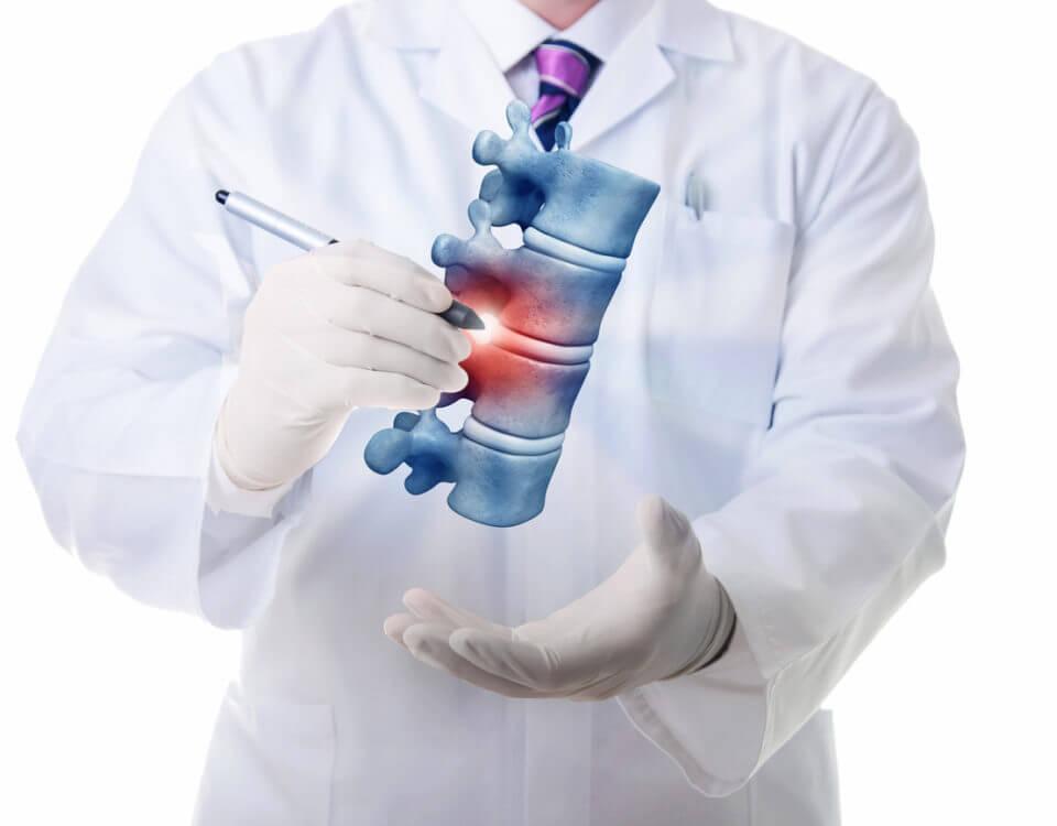 Man holding spine model