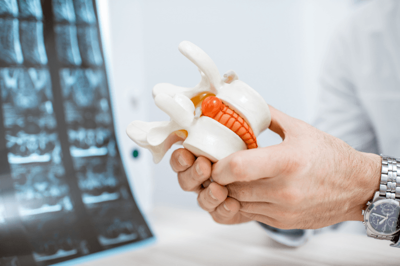 A Doctor Explaining Artificial Disc Replacement in Miami & South Florida