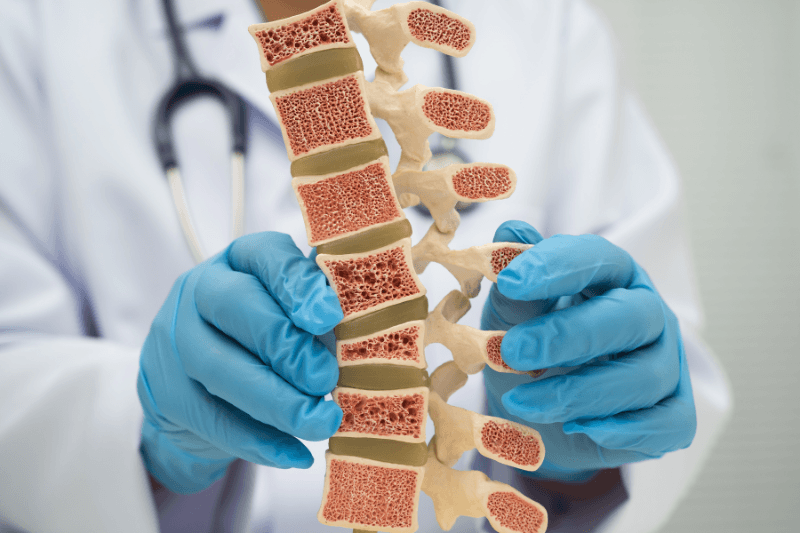 Kyphoplasty & Vertebroplasty at Spine Solutions in Miami, FL