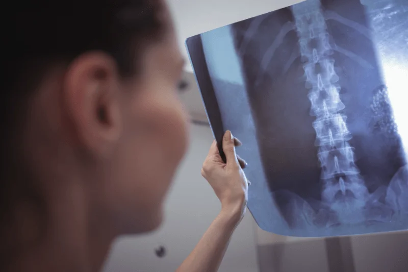 A Spine Surgeon Reviews a Spine X-Ray at a Spine Surgery Clinic in South Florida