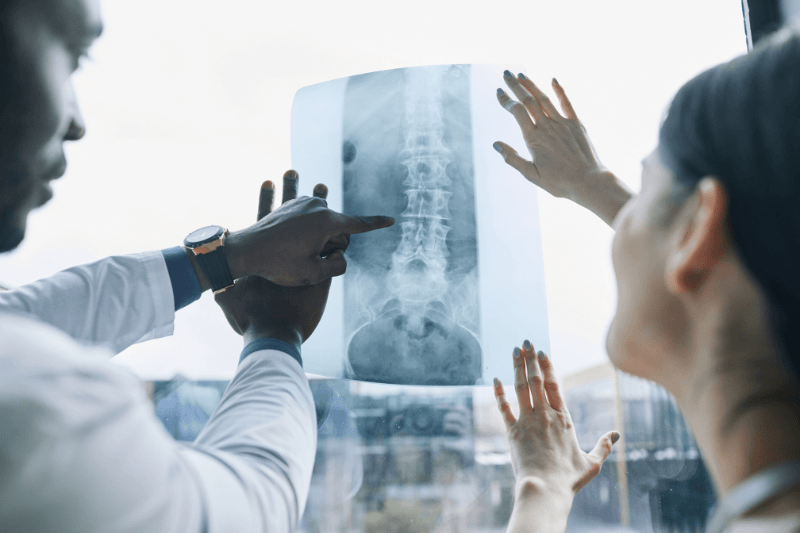 Spine Surgeons Review X-Rays and Consider Spinal Fusion in Miami & South Florida